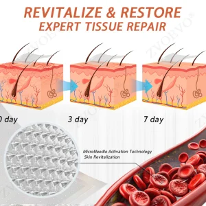 Zvoevo® Vein Ease Microneedle Care Patch 21 Zvoevo® Vein Ease Microneedle Care Patch