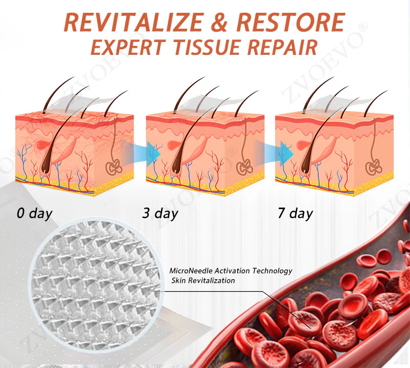 Zvoevo® Vein Ease Microneedle Care Patch 11 Zvoevo® Vein Ease Microneedle Care Patch - Image 11