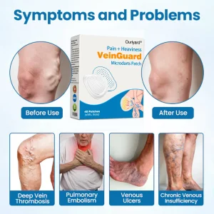 Ourlyard® VeinGuard Pain & Heaviness Microdarts Patch 20 Ourlyard® VeinGuard Pain & Heaviness Microdarts Patch