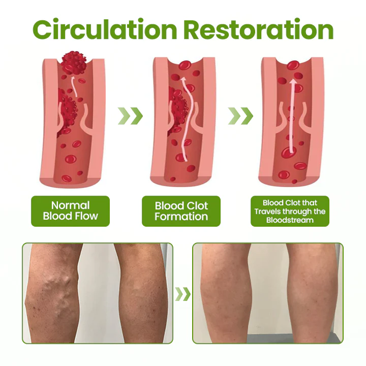 Timilk®VeinEase Leg Mask 5 Timilk®VeinEase Leg Mask