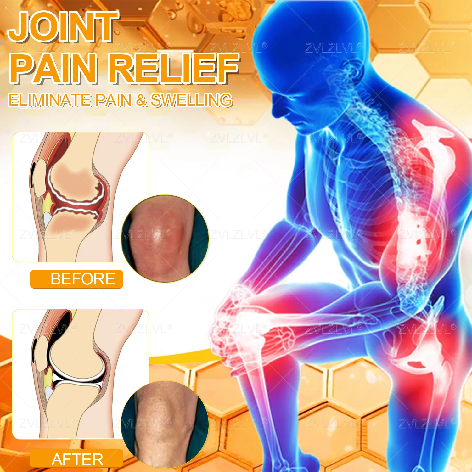 ZVLZVL® Bee Venom Pain-Relief Bone Healing Cream 5 ZVLZVL® Bee Venom Pain-Relief Bone Healing Cream - Image 5