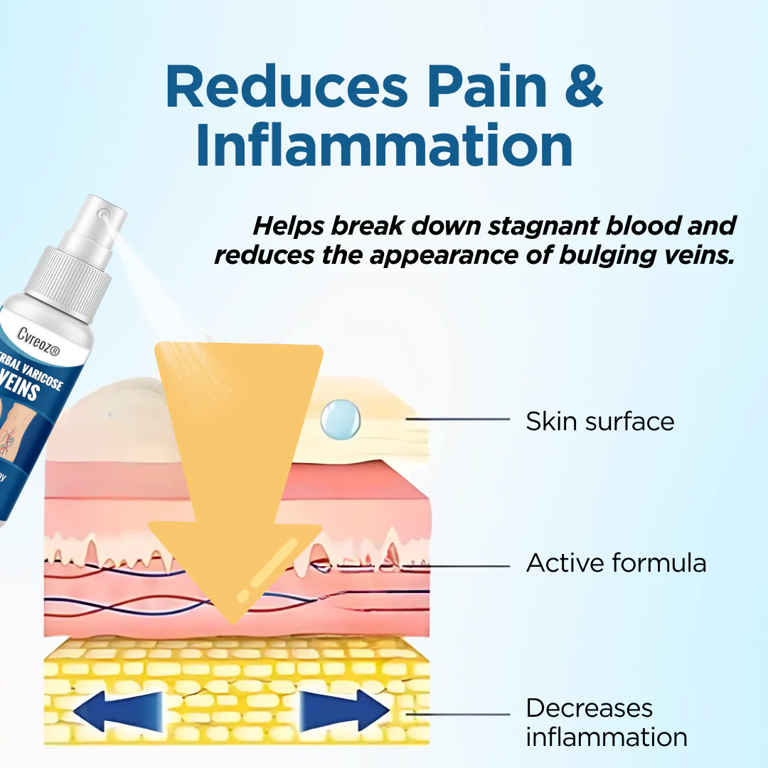 Cvreoz® Herbal Varicose Veins Treatment Spray 6 Cvreoz® Herbal Varicose Veins Treatment Spray - Image 6