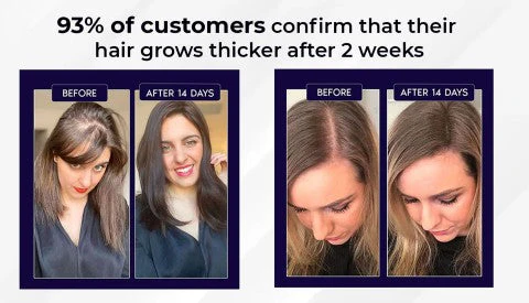 HZA™ Natural Hair Regrowth Spray 10 HZA™ Natural Hair Regrowth Spray