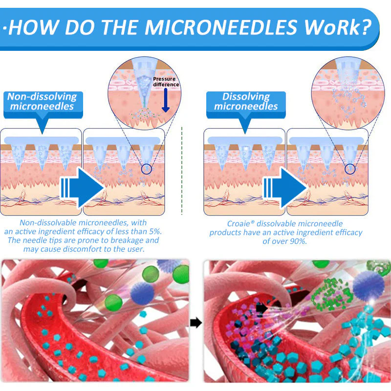 Croaie® NIDDK-Tirzepatide & Matrixyl 3000 Nano Microneedle Patch 8 Croaie® NIDDK-Tirzepatide & Matrixyl 3000 Nano Microneedle Patch