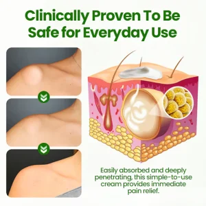 Cvreoz® KnotAway Lipoma Removal Cream 12 Cvreoz® KnotAway Lipoma Removal Cream