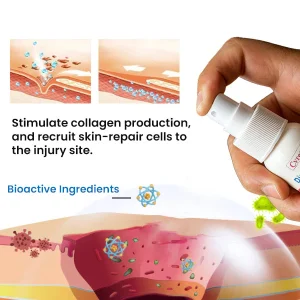 Cvreoz® Diabetic Foot Healing Spray 11 Cvreoz® Diabetic Foot Healing Spray