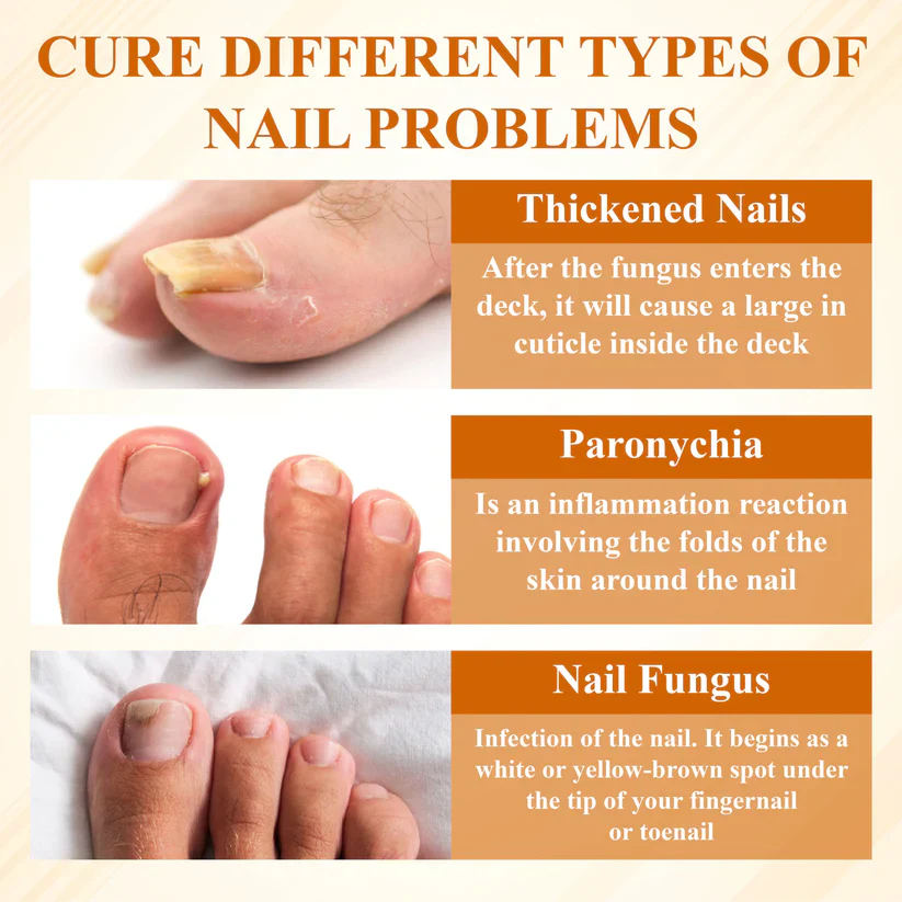 BBOJI® Fungiclear Bee Therapy Nail Spray 8 BBOJI® Fungiclear Bee Therapy Nail Spray - Image 8