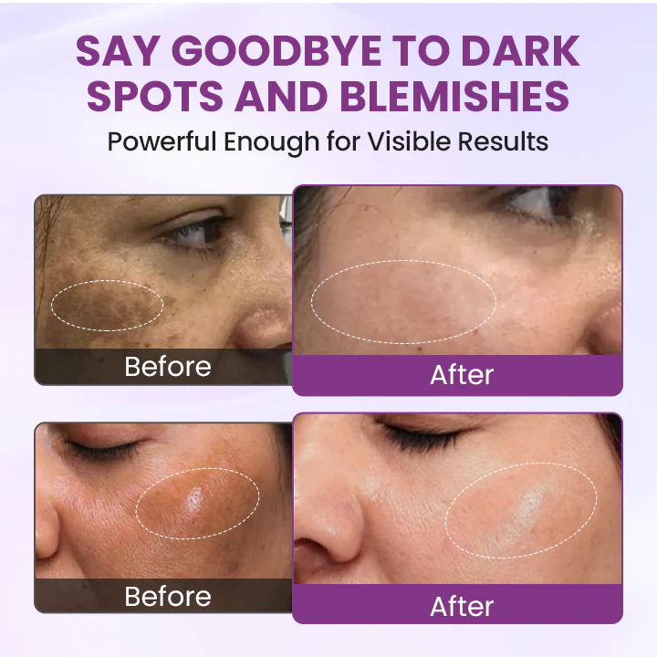 Biancat® RadiantClear Blemish & Brightening Serum 8 Biancat® RadiantClear Blemish & Brightening Serum