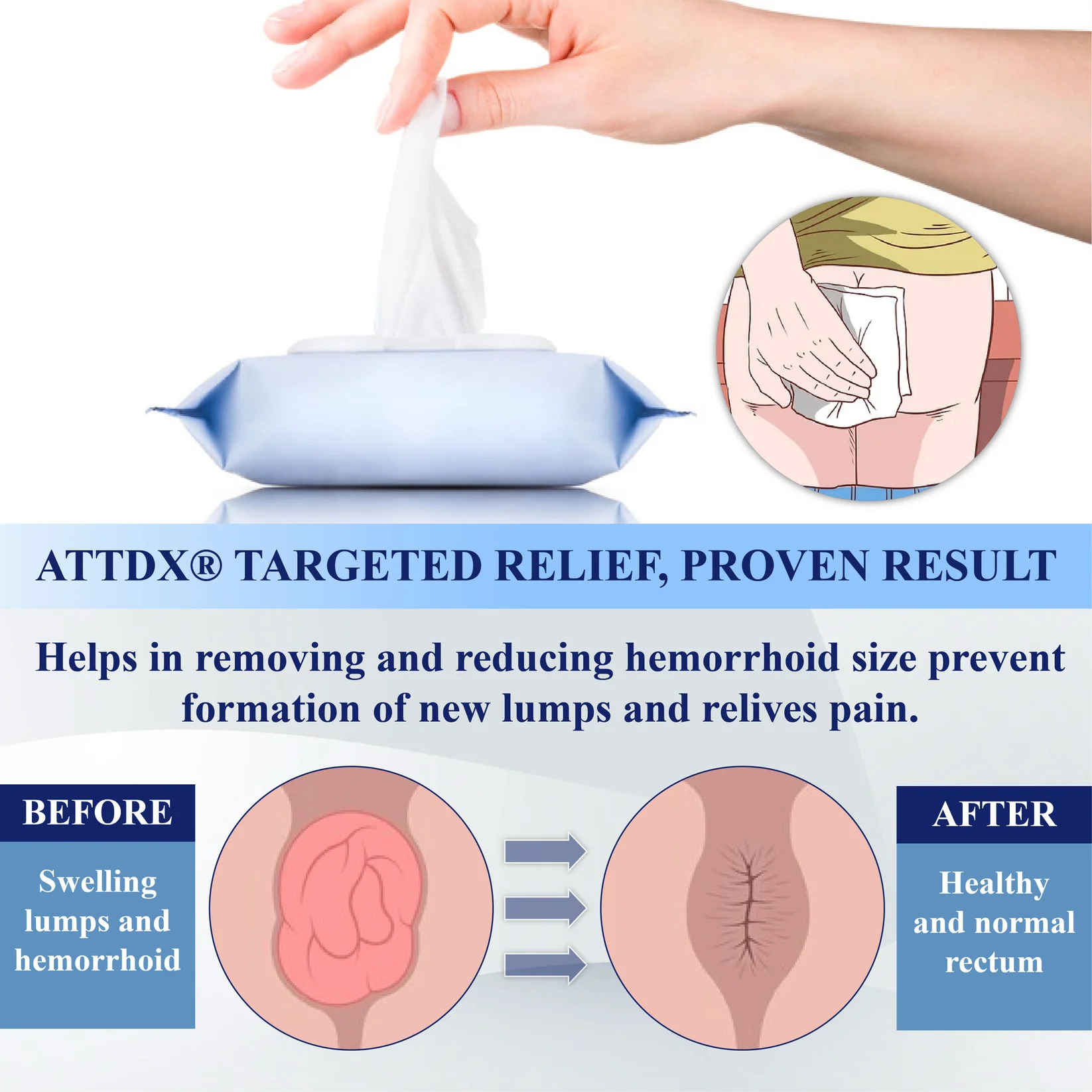 ATTDX® Advanced Relief Hemorrhoid Flushable Wipes 4 ATTDX® Advanced Relief Hemorrhoid Flushable Wipes - Image 4