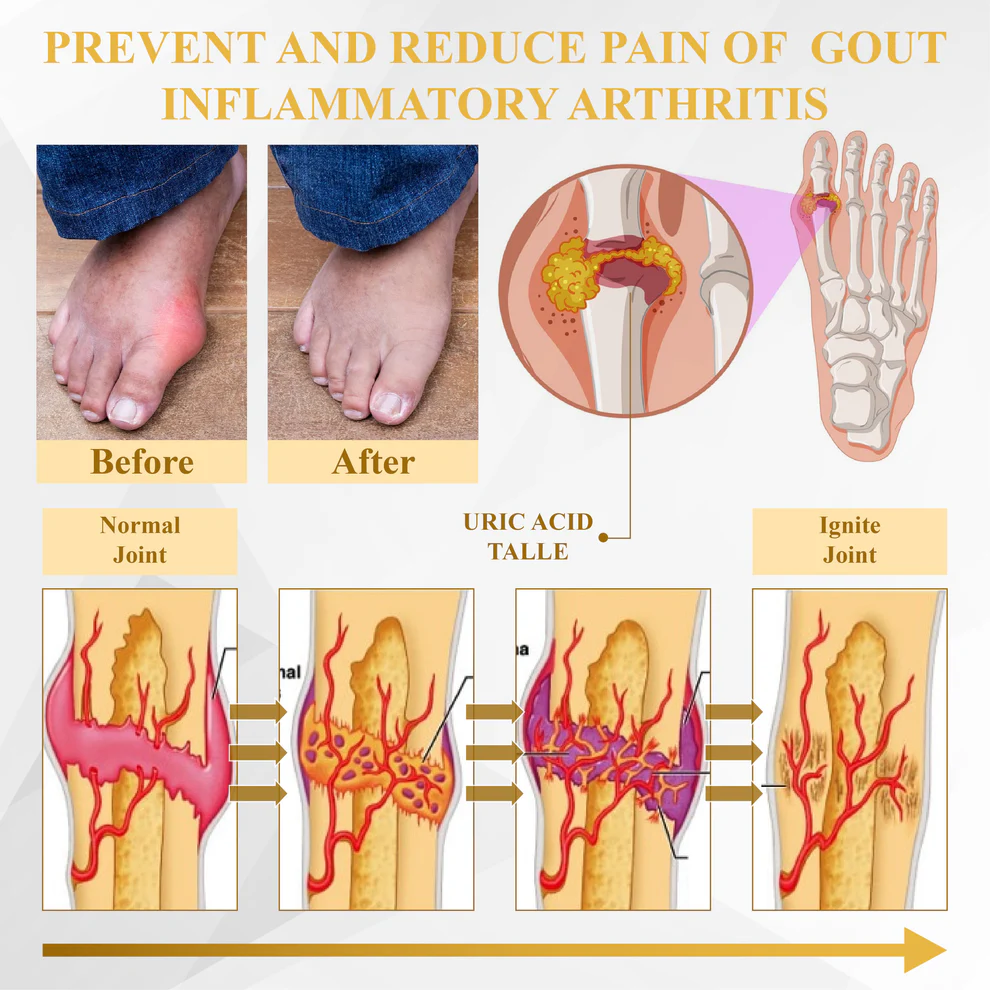 ATTDX® ApiMotion Herbal Joint Comfort Balm 7 ATTDX® ApiMotion Herbal Joint Comfort Balm