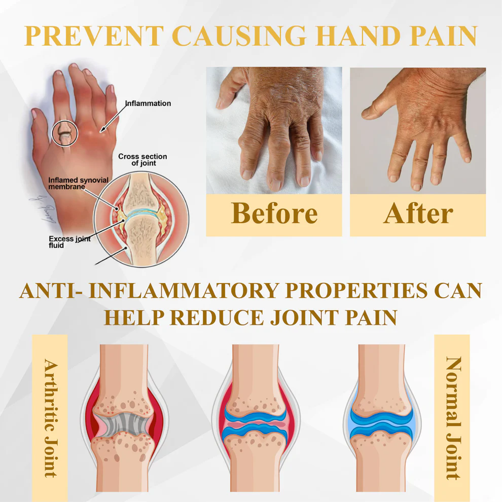 ATTDX® ApiMotion Herbal Joint Comfort Balm 6 ATTDX® ApiMotion Herbal Joint Comfort Balm