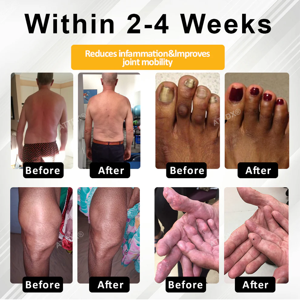 ATTDX® ApiMotion Herbal Joint Comfort Balm 3 ATTDX® ApiMotion Herbal Joint Comfort Balm