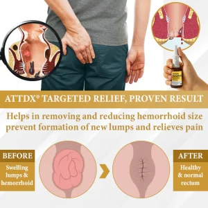 ATTDX® Apis Venom Hemorrhoid Cooling Spray 11 ATTDX® Apis Venom Hemorrhoid Cooling Spray