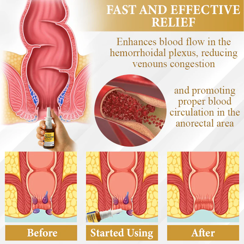 ATTDX® Apis Venom Hemorrhoid Cooling Spray 2 ATTDX® Apis Venom Hemorrhoid Cooling Spray