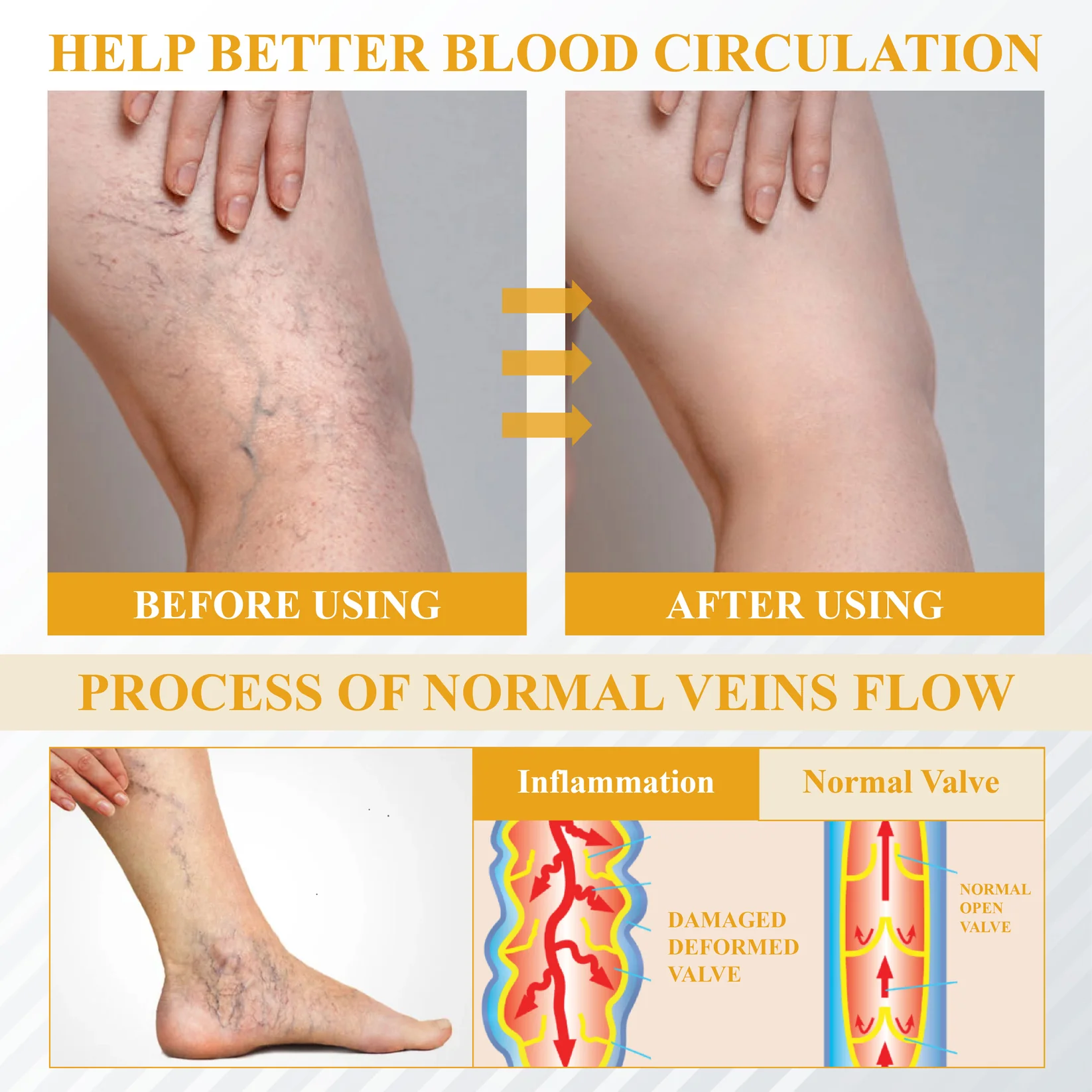 ATTDX® Bromelain Edema & Vein Care Cream 6 ATTDX® Bromelain Edema & Vein Care Cream - Image 6