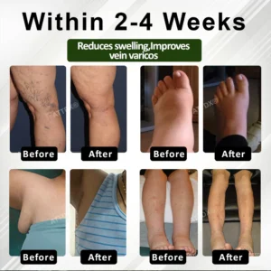 ATTDX® HormoBalance Edema Ear Patch 19 ATTDX® HormoBalance Edema Ear Patch