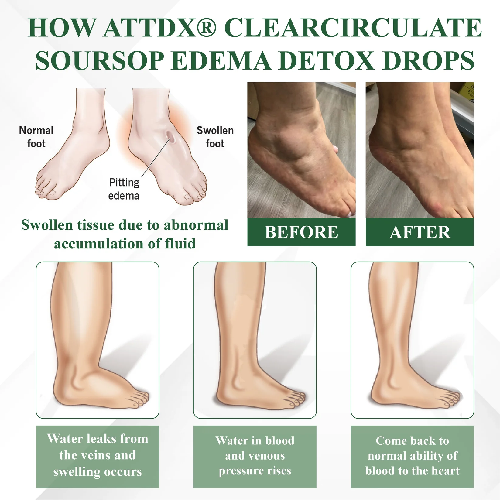 ATTDX® ClearCirculate Soursop Edema Detox Drops 7 ATTDX® ClearCirculate Soursop Edema Detox Drops - Image 7