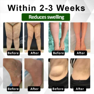 ATTDX® ClearCirculate Soursop Edema Detox Drops 16 ATTDX® ClearCirculate Soursop Edema Detox Drops