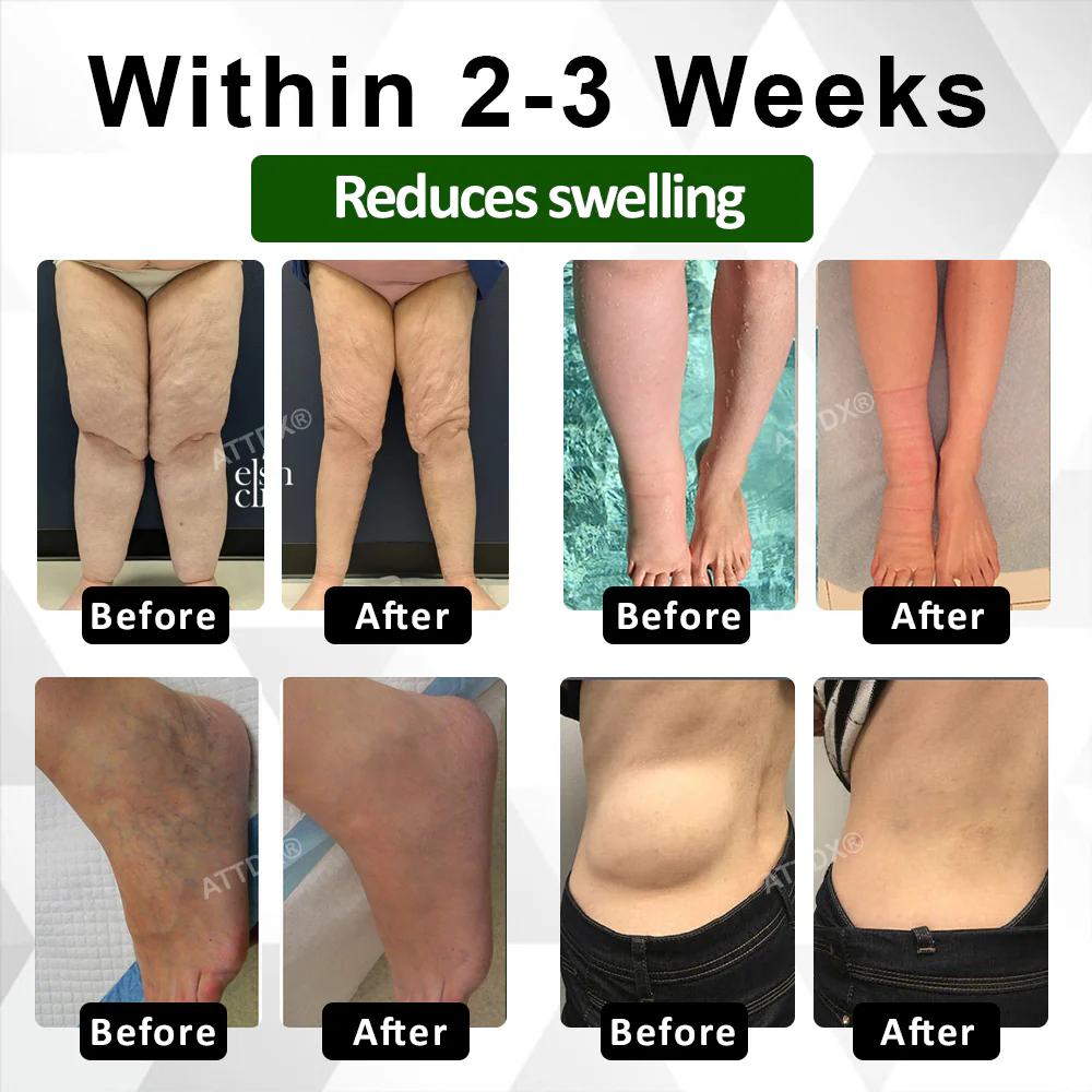 ATTDX® ClearCirculate Soursop Edema Detox Drops 4 ATTDX® ClearCirculate Soursop Edema Detox Drops - Image 4