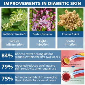 CVREOZ® Diabetes Foot Guard Fast Recovery Spray 20 CVREOZ® Diabetes Foot Guard Fast Recovery Spray