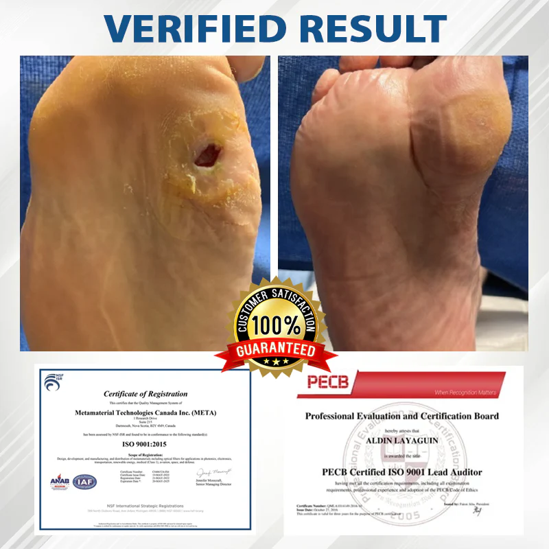 CVREOZ® Diabetes Foot Guard Fast Recovery Spray 5 CVREOZ® Diabetes Foot Guard Fast Recovery Spray