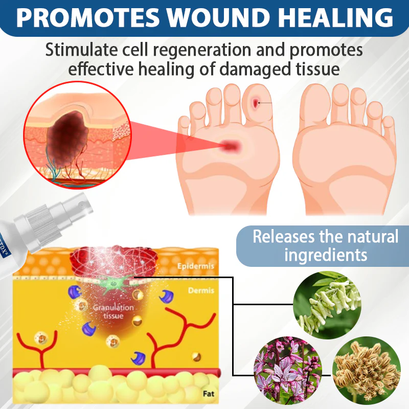 CVREOZ® Diabetes Foot Guard Fast Recovery Spray 6 CVREOZ® Diabetes Foot Guard Fast Recovery Spray