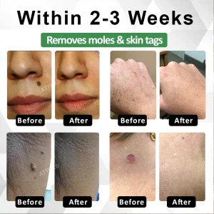 ATTDX® Herdle Shot Spot & Mole Correct Serum 13 ATTDX® Herdle Shot Spot & Mole Correct Serum