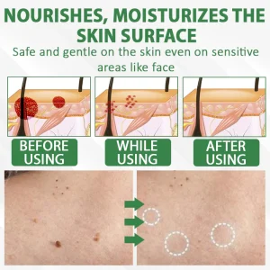 ATTDX® Herdle Shot Spot & Mole Correct Serum 17 ATTDX® Herdle Shot Spot & Mole Correct Serum