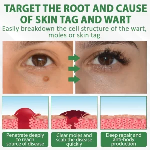 ATTDX® Herdle Shot Spot & Mole Correct Serum 15 ATTDX® Herdle Shot Spot & Mole Correct Serum