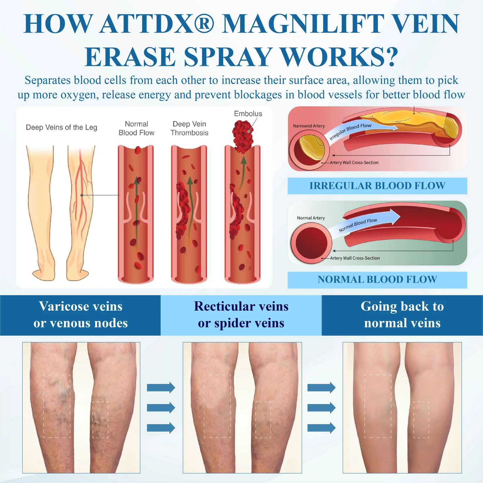 ATTDX® MagniLift VeinErase Spray 5 ATTDX® MagniLift VeinErase Spray - Image 5