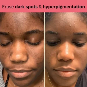 Kojic Acid Turmeric Overnight Mask 16 Kojic Acid Turmeric Overnight Mask