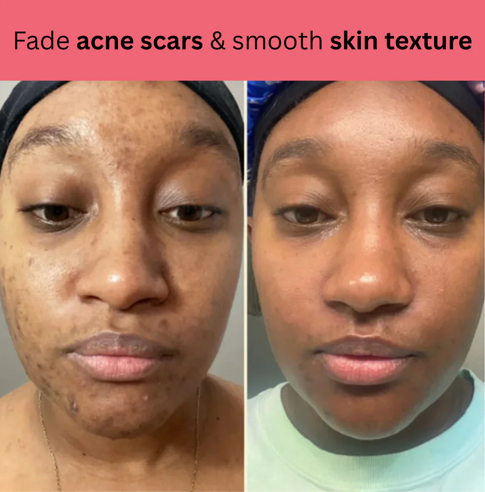 Kojic Acid Turmeric Overnight Mask 5 Kojic Acid Turmeric Overnight Mask