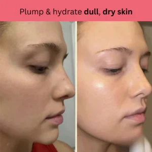 Kojic Acid Turmeric Overnight Mask 14 Kojic Acid Turmeric Overnight Mask