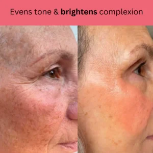 Kojic Acid Turmeric Overnight Mask 15 Kojic Acid Turmeric Overnight Mask