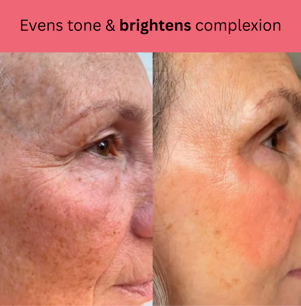 Kojic Acid Turmeric Overnight Mask 7 Kojic Acid Turmeric Overnight Mask