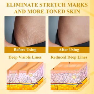 Apisderm™ BotoxBee Advanced Multi-Action FirmingCream 100g 24 Apisderm™ BotoxBee Advanced Multi-Action FirmingCream 100g