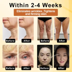 ApisDerm™ Bo-toxBee Advanced Multi-Action FirmingCream 16 ApisDerm™ Bo-toxBee Advanced Multi-Action FirmingCream