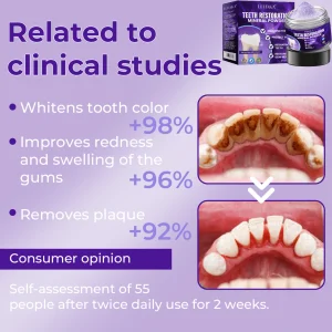 LUHAKA® Dental Repair Mineral Powder 14 LUHAKA® Dental Repair Mineral Powder