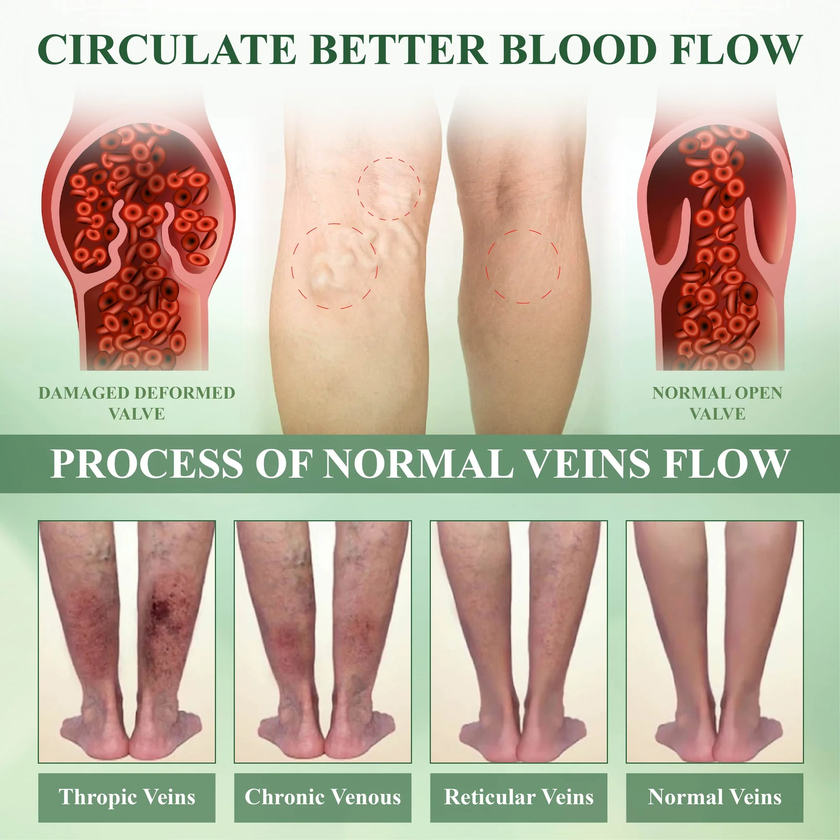 ATTDX® ClearCirculate Soursop Edema Detox Drops 11 ATTDX® ClearCirculate Soursop Edema Detox Drops - Image 11