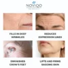 Noviqo™ – Anti-Wrinkle Freeze-Dried Nano-Silk Collagen System 6 Noviqo™ – Anti-Wrinkle Freeze-Dried Nano-Silk Collagen System