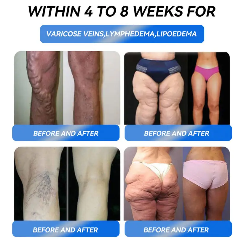 Honxi® GLP-1 Pro Weight Loss Oral Solution 5 Honxi® GLP-1 Pro Weight Loss Oral Solution