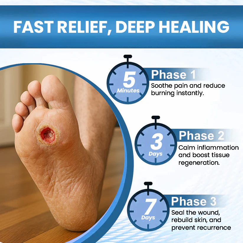 Cvreoz® Diabetic Foot Healing Cream 2 Cvreoz® Diabetic Foot Healing Cream