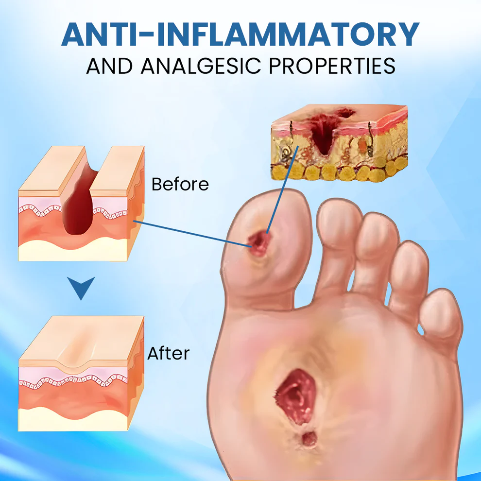 Cvreoz® Diabetic Foot Healing Cream 5 Cvreoz® Diabetic Foot Healing Cream