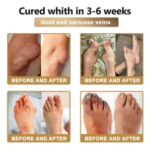 PolarFresh® Bee Venom & Botulinum Toxin Joint Pain Relief & Repair Cream 20 PolarFresh® Bee Venom & Botulinum Toxin Joint Pain Relief & Repair Cream