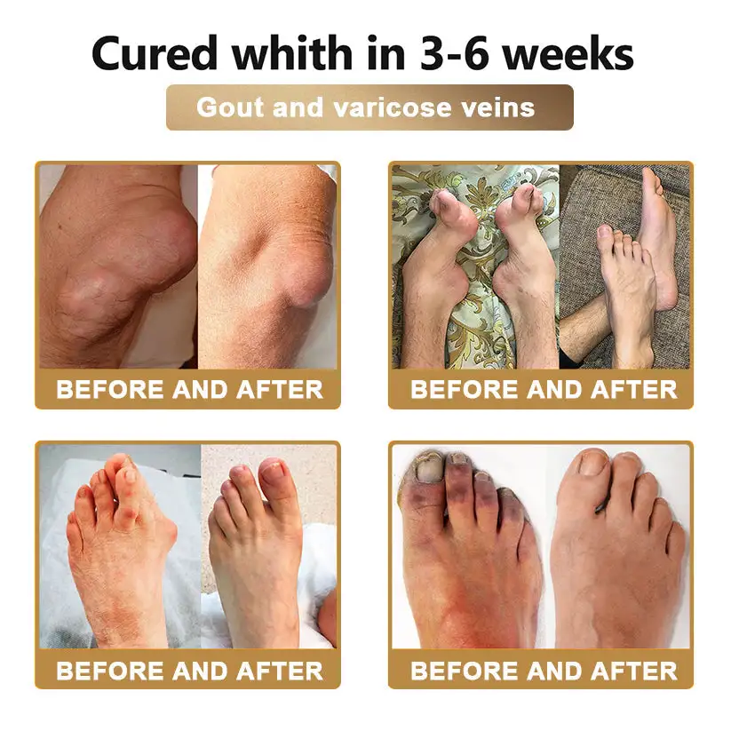 PolarFresh® Bee Venom & Botulinum Toxin Joint Pain Relief & Repair Cream 8 PolarFresh® Bee Venom & Botulinum Toxin Joint Pain Relief & Repair Cream - Image 8