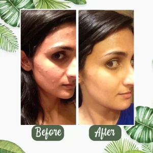 Green Tea Deep Cleansing Mask 20 Green Tea Deep Cleansing Mask