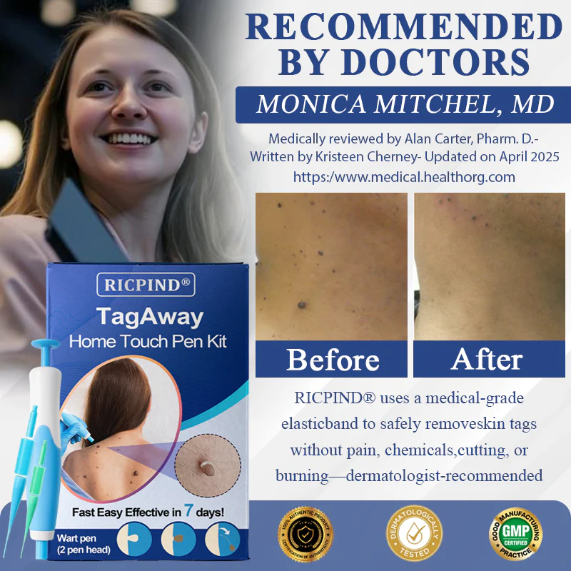 RICPIND® TagAway Home Touch Pen Kit