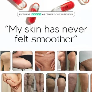 New Maximum Potency Anti-Loose Skin Capsules | Smooth Skin by Sculptique™