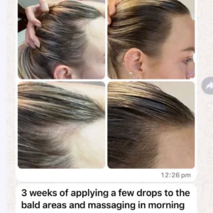 Vita-Growth Scalp Serum