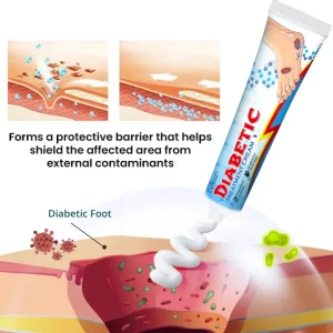 CVREOZ® BioVitaGlyco Diabetes Treatment Cream 16 CVREOZ® BioVitaGlyco Diabetes Treatment Cream